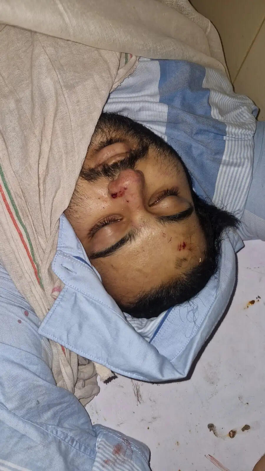 इलाज के दौरान दो लोगों को मृत घोषित कर दिया गया। एक घायल ने पुलिस को बताया कि मृतकों में अबान अहमद, माफिया अतीक अहमद का सबसे छोटा बेटा है।