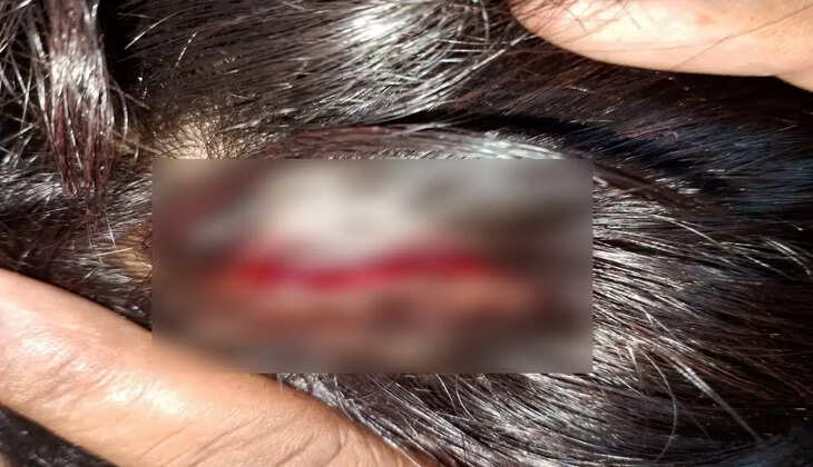 Gorakhpur News: सहजनवां में&nbsp;शराब के लिए पैसा न देने पर दबंगों ने फोड़ दिया सर