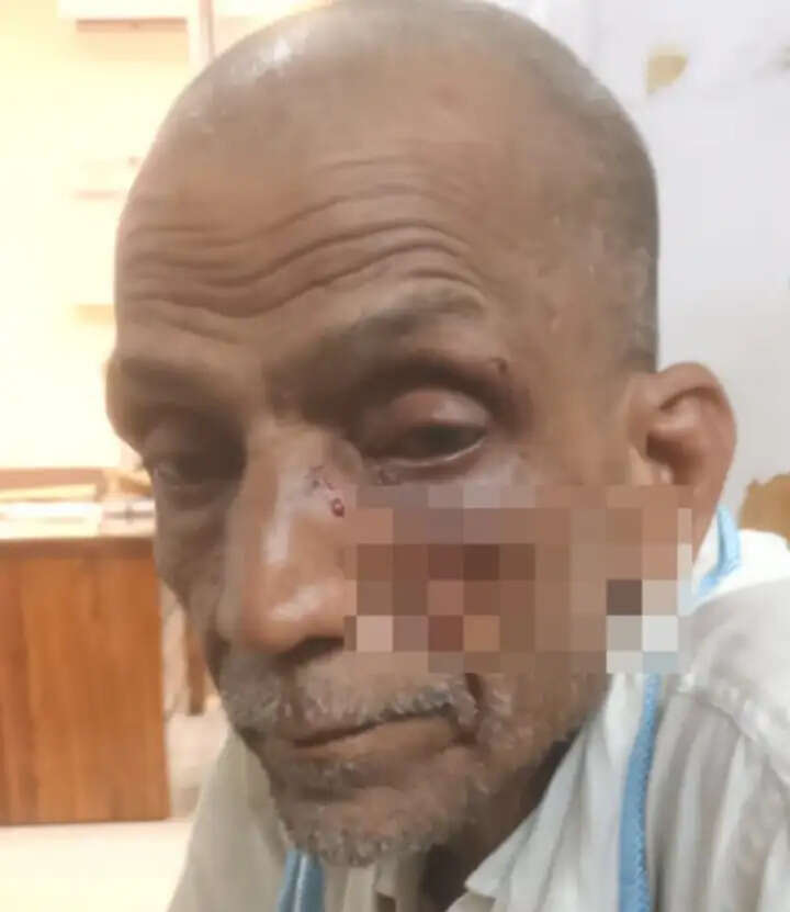 रवि शंकर त्रिपाठी ने पुलिस को दी तहरीर में आरोप लगाया कि बात सुनने के बाद कुंदन सेठ और सुनील सेठ मौके पर पहुंचे। दोनों ने उनके साथ लात-घूंसों से मारपीट शुरू कर दी। मारपीट में वह गंभीर रूप से घायल हो गए। आरोप है कि हमला करने के बाद आरोपी मौके से फरार हो गए।