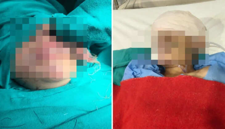 फिलहाल बच्चे के परिवार की मांग CCTV फुटेज की जांच और घटना की स्पष्ट तस्वीर सामने लाने की है। वहीं BHU प्रशासन की जांच के बाद ही यह स्पष्ट हो सकेगा कि बच्चे को चोट कैसे लगी और इस मामले में जिम्मेदारी किसकी बनती है।