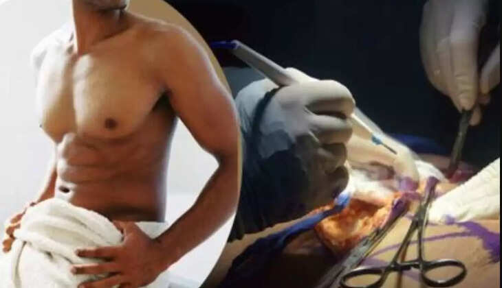Oh No! Sex के दौरान अचानक टूट गया शख्स का प्राइवेट पार्ट, और फिर&hellip; Video Social Media पर Viral