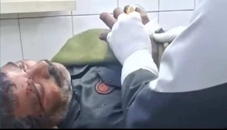 चंदौली में सनकी दामाद ने कुल्हाणी से वार कर सास ससुर को किया लहूलुहान, दोनों की हालत गंभीर