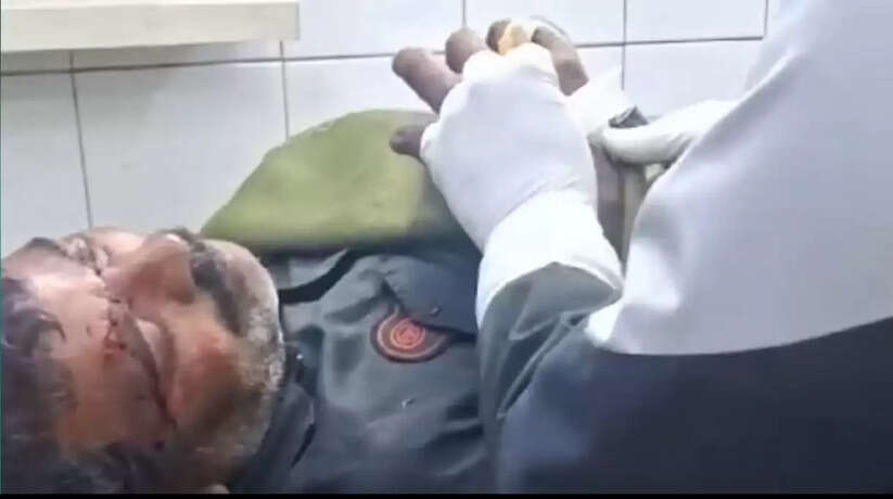 चंदौली में सनकी दामाद ने कुल्हाणी से वार कर सास ससुर को किया लहूलुहान, दोनों की हालत गंभीर