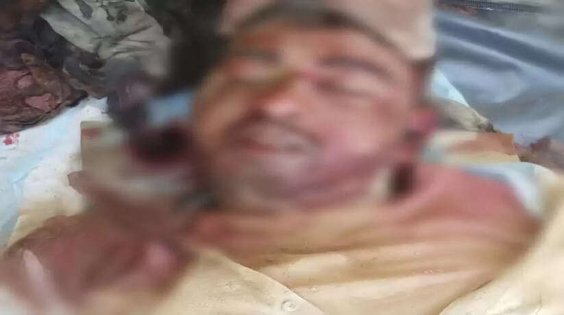 निर्माणाधीन बाइपास मार्ग पर रखे मिट्टी के ढेर से टकराकर बाइक सवार युवक की मौत