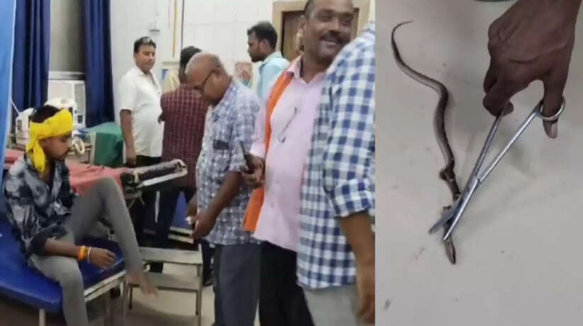 चन्दौली में एक युवक को सांप ने डंसा, युवक सांप लेकर पहुंचा जिला अस्पताल