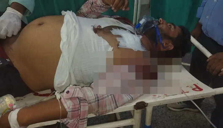 गोरखपुर में गोलीकांड: 2 लाख की लूट के दावे पर उठे सवाल, जांच में जुटी पुलिस