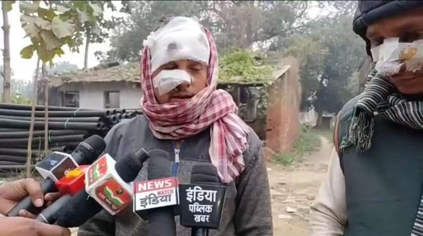 Chandauli News: चंदौली में रॉड से मारपीट कर दो को किया घायल, गांव में तनाव