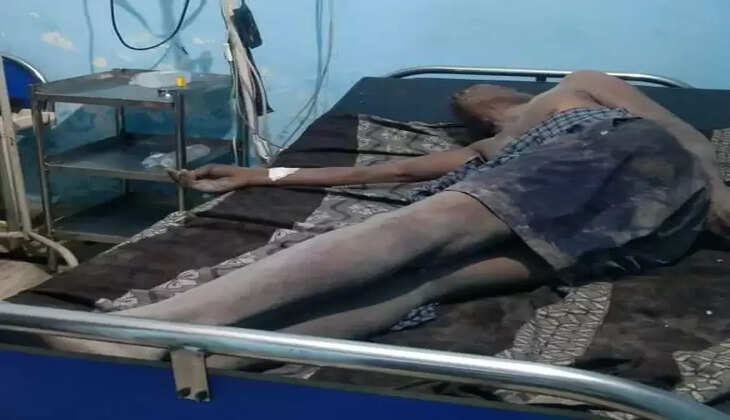 लटक रहे बिजली के तार के चपेट में आने से बूरी तरह झुलसा मजदूर