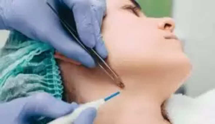ऑपरेशन के दौरान महिला रोई तो अस्पताल वालों ने लिया रोने का भी चार्ज, बिल वायरल