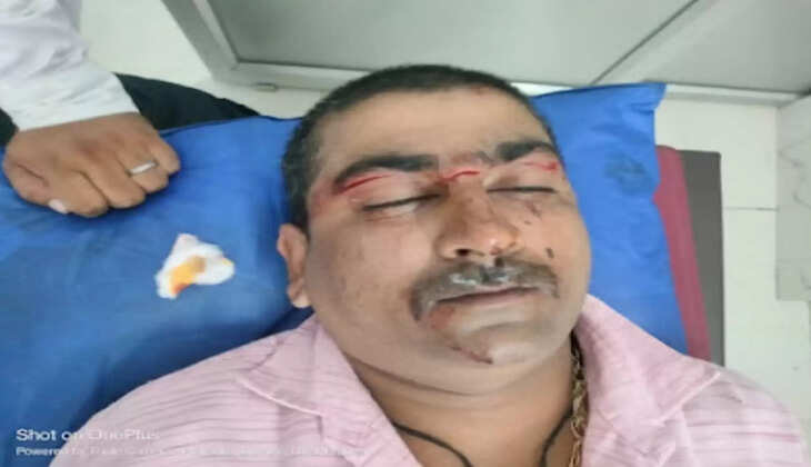 Prayagraj News:&nbsp;प्रयागराज में यमुना पुल पर चाइनीस मांझा से बाइक सवार घायल बाल बाल बची जान