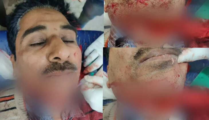 चन्दौली में पतंग के मांझे से बाइक सवार की गर्दन बुरी तरह कटी, वाराणसी ट्रामा सेंटर रेफर